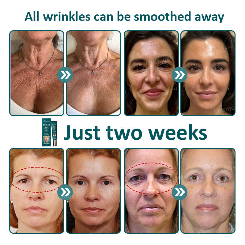 🪼👨⚕️Made and shipped from the UK✨Flysmus® Botox Jellyfish Venom Peptide Nanoliposome Sculpting Anti-Wrinkle Cream – Hot Seller! 🔥Limited-Time Offer: Save 40%!