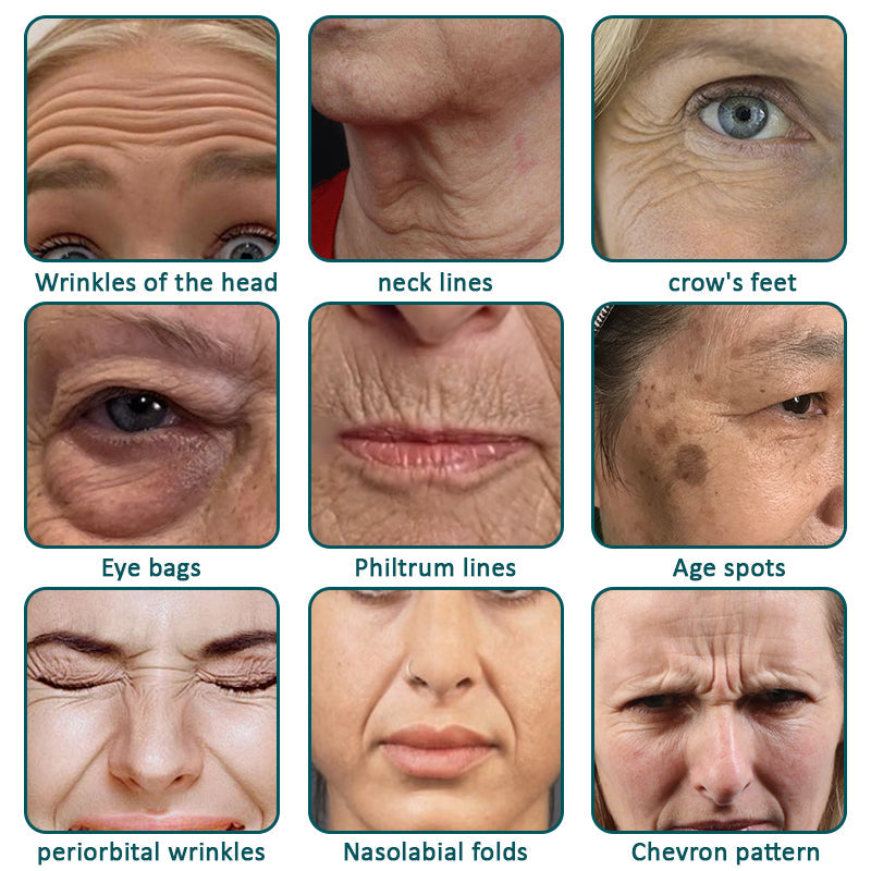 🪼👨⚕️Made and shipped from the UK✨Flysmus® Botox Jellyfish Venom Peptide Nanoliposome Sculpting Anti-Wrinkle Cream – Hot Seller! 🔥Limited-Time Offer: Save 40%!
