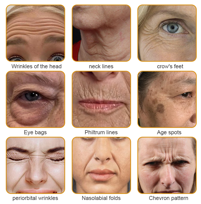 💎👨⚕️Made and shipped from the UK✨Flysmus® Botox Bee Venom Wrinkle Removal Cream-Last Day Promotion 70% OFF