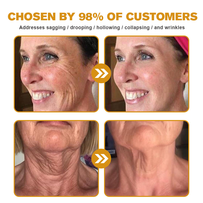 💎👨‍⚕️Made and shipped from the UK✨Flysmus® Botox Bee Venom Wrinkle Removal Cream-Last Day Promotion 70% OFF