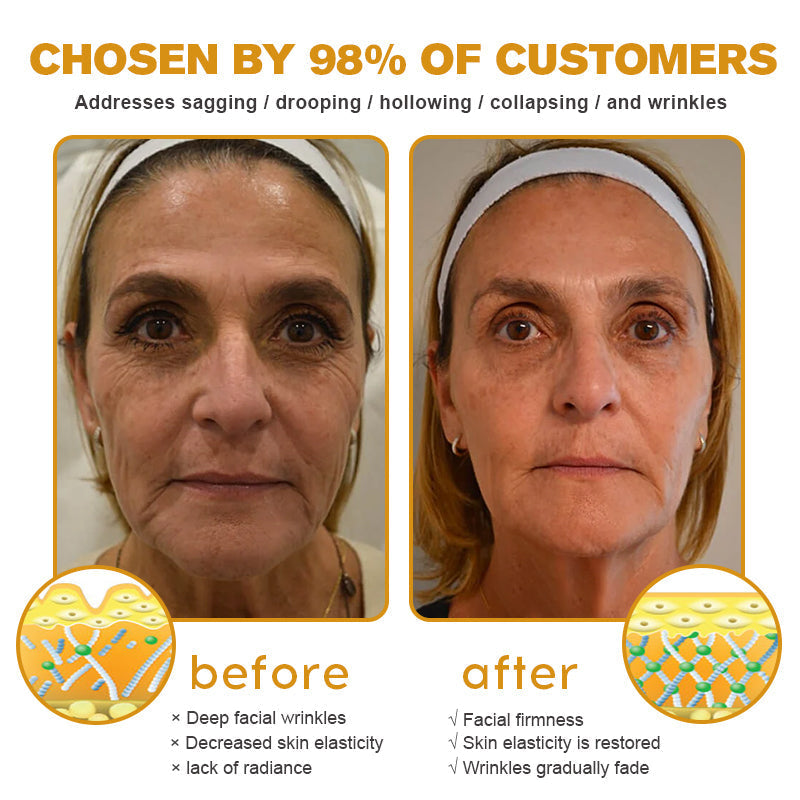 💎👨‍⚕️Made and shipped from the UK✨Flysmus® Botox Bee Venom Wrinkle Removal Cream-Last Day Promotion 70% OFF