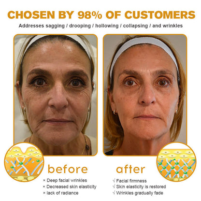 💎👨‍⚕️Made and shipped from the UK✨Flysmus® Botox Bee Venom Wrinkle Removal Cream-Last Day Promotion 70% OFF